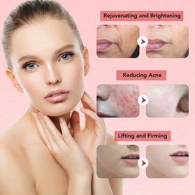 7-in-1 Facial Massager – EMS, RF, Microcurrent Anti-Aging Device
