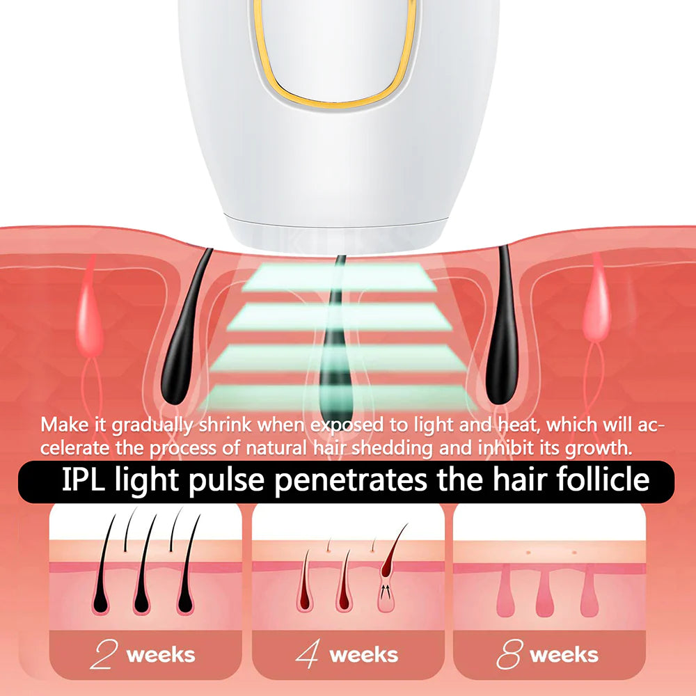 IPL Hair Removal Laser Epilator – 600,000 Flashes