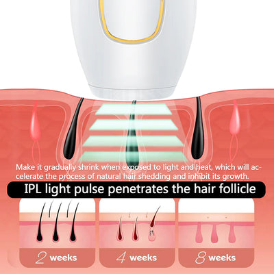 IPL Hair Removal Laser Epilator – 600,000 Flashes